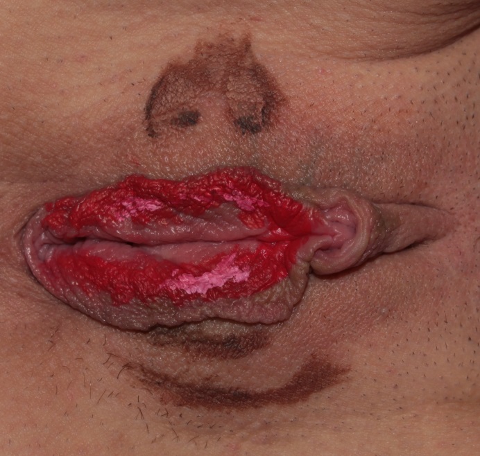 Painting on labia of nose lips chin