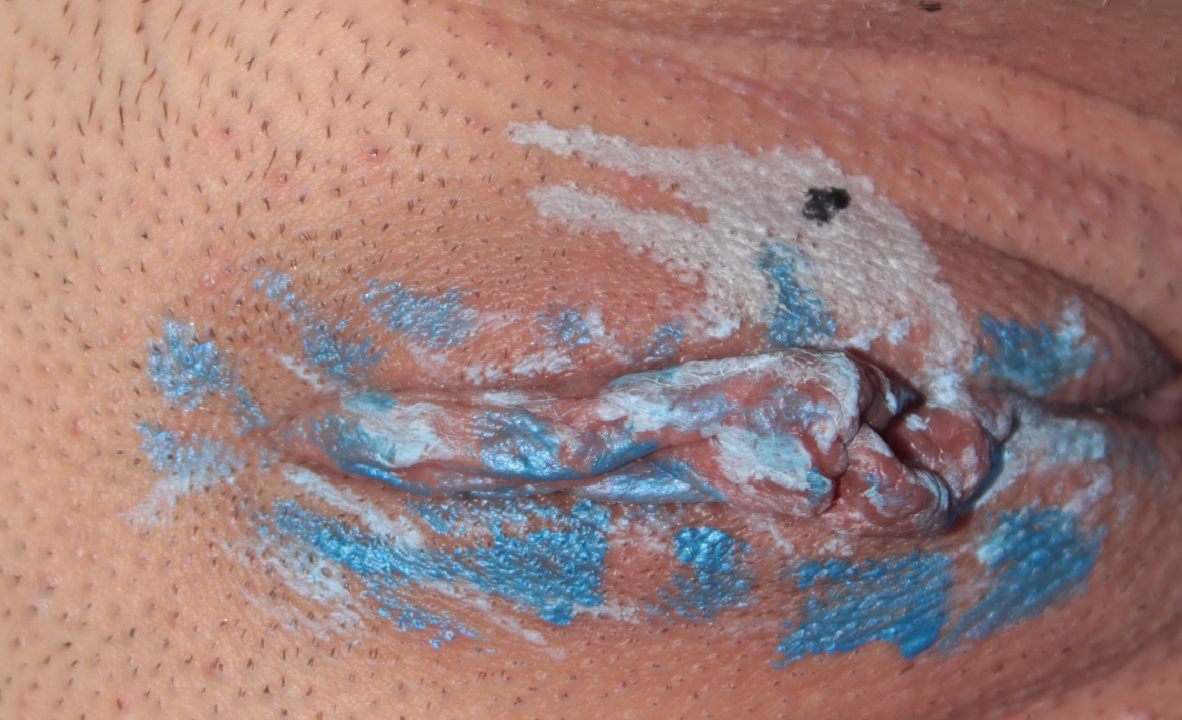dolphin cresting out of the water body painted over labia.
